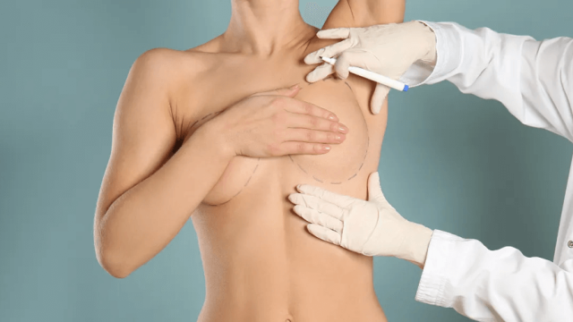 Reconstrução mamária: um passo essencial na jornada de cura