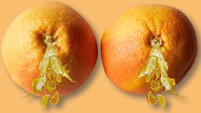 Atenção à secreção mamária: quando é hora de procurar ajuda?