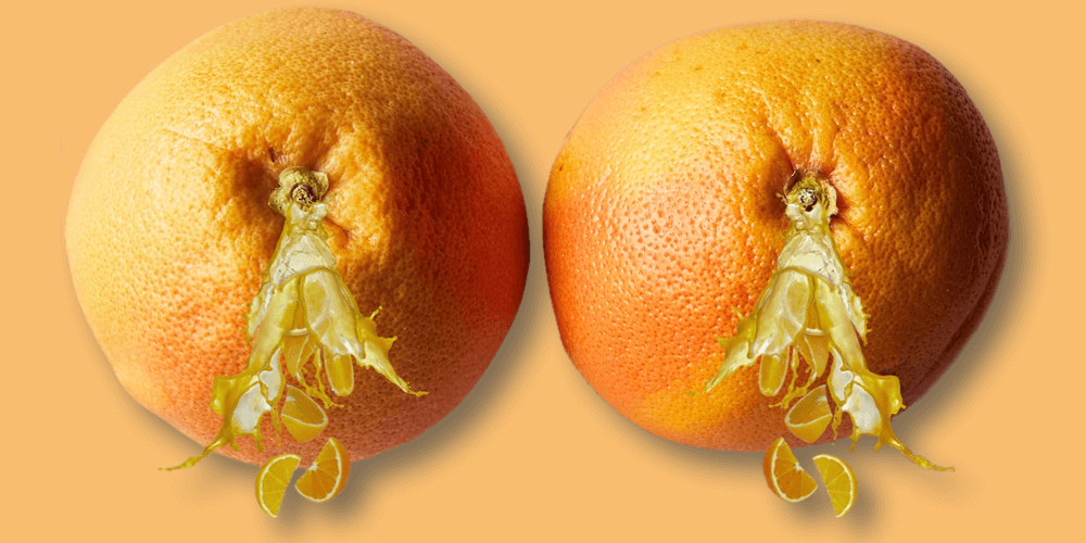 Atenção à secreção mamária: quando é hora de procurar ajuda?