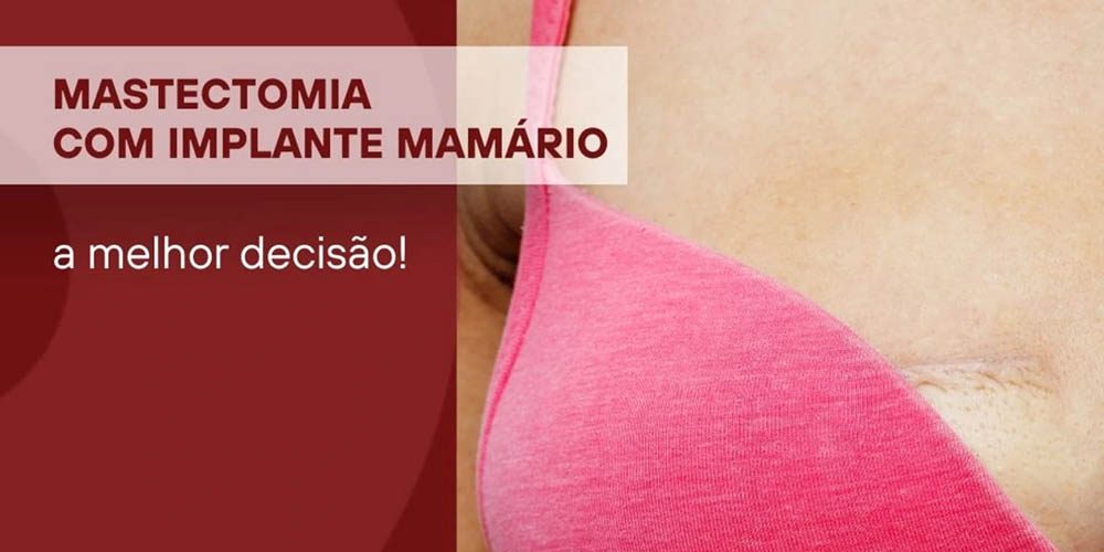 Mastectomia com implante mamário, a melhor decisão!