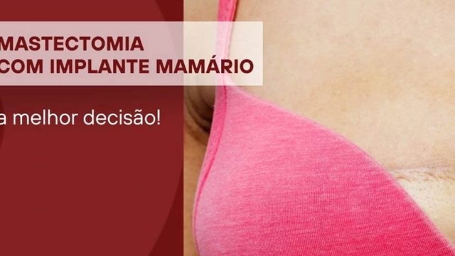 Mastectomia com implante mamário, a melhor decisão!