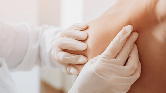 Mastologia: cuidado que acolhe, orienta e transforma