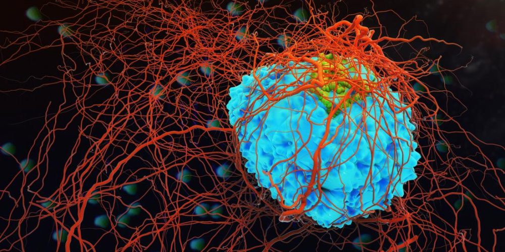 Nova droga aprovada nos EUA traz esperança para o tratamento do câncer de mama