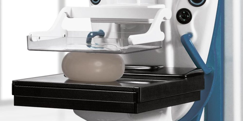 Estudo de câncer reacende debate sobre quando iniciar mamografias periódicas