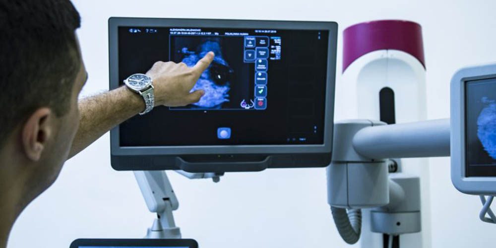 Menopausa e ectasia ductal, como tratar?