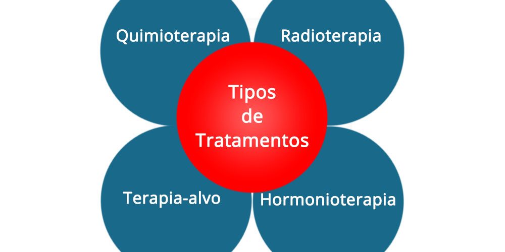 Quais são os tratamentos de câncer de mama