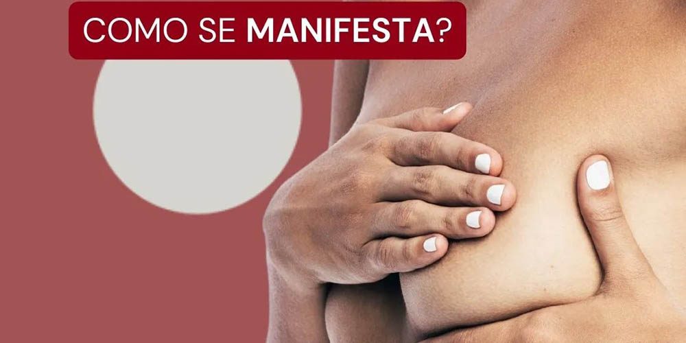 Carcinoma Ductal Invasivo | Como se manisfesta?