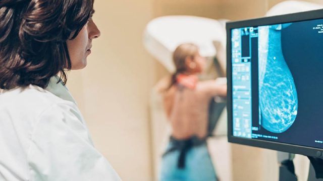 Câncer de mama | Diagóstico precoce e rastreamento