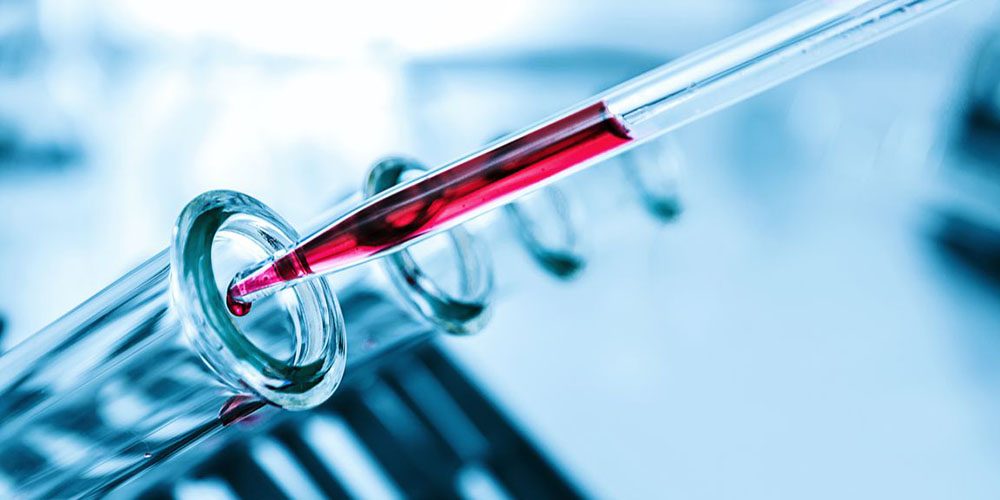 Exame de sangue ajuda no diagnóstico precoce de câncer de mama, aponta estudo