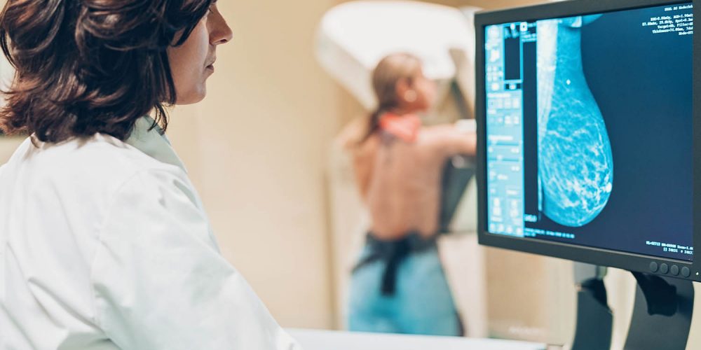 Quem Tem Silicone Não Pode Fazer Mamografia – Mito ou Verdade