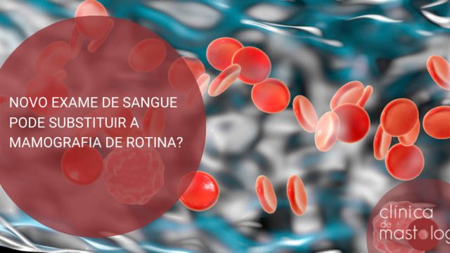 Novo exame de sangue pode substituir a mamografia de rotina?