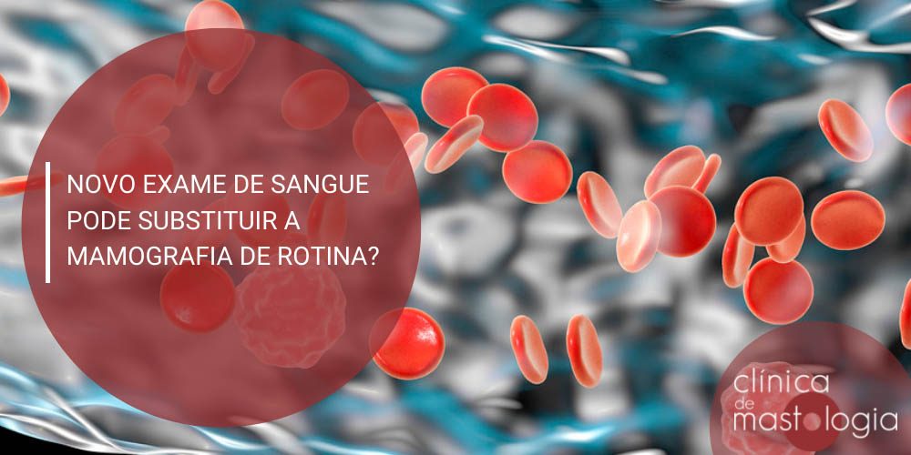 Novo exame de sangue pode substituir a mamografia de rotina?