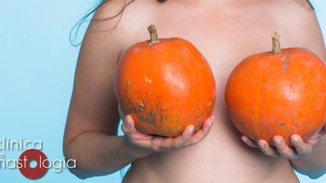 Assimetria focal da mama é doença?