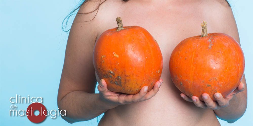 Assimetria focal da mama é doença?